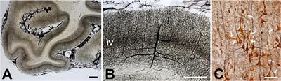 Toward Long-Term Communication With the Brain in the Blind by Intracortical Stimulation: Challenges and Future Prospects